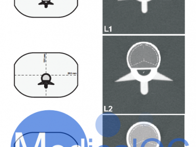 德国QRM-ESP骨密度模体图2