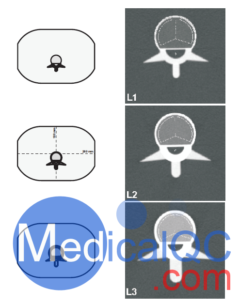 QRM-ESP脊柱模体三个脊椎插件的横断面剖视图