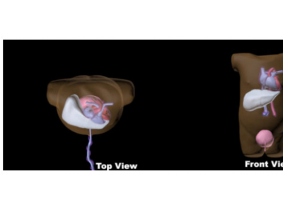 US-NO1新生儿躯干超声模体图2