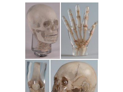 德国Erler Zimmer天然骨骼X-Ray训练模体图3