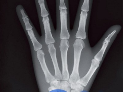 德国Erler Zimmer天然骨骼X-Ray训练模体图2