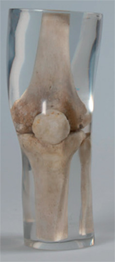 Erler Zimmer天然骨骼模体，Erler Zimmer膝盖模体