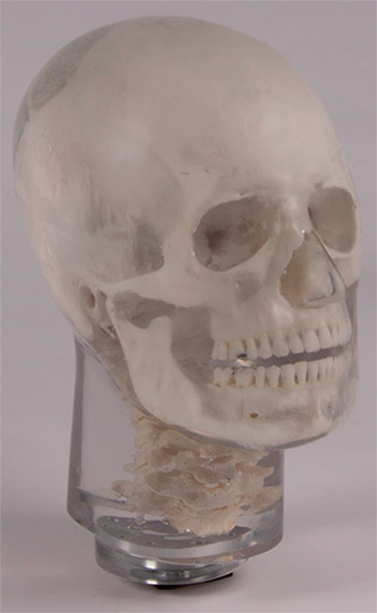 Erler Zimmer天然骨骼模体，Erler Zimmer头部模体