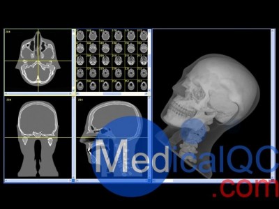 CIRS 711-HN头部模体图2