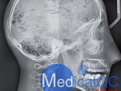 CIRS 711-HN头部模体图3