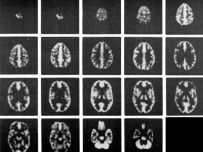 Hoffman 3-D脑模体，霍夫曼脑模体图2