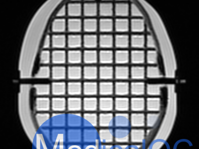 CIRS 603A头部模体图4