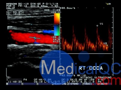 CIRS 043多普勒模体图2