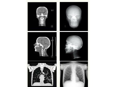KYOTO KAGAKU PBU-60全身CT模体图3