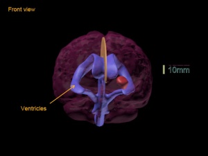 Truephantom BN-A01标准成人脑模体