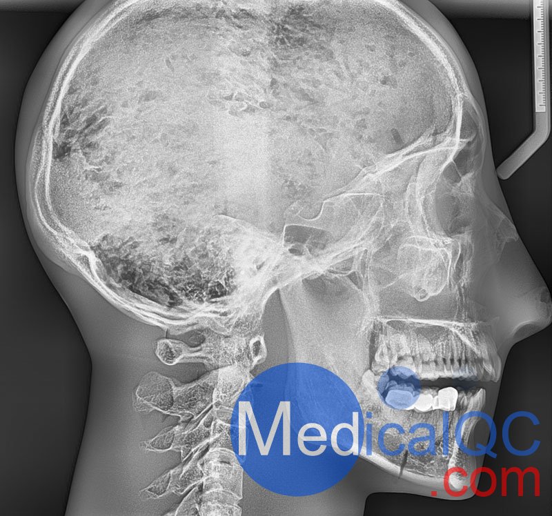 WEK-7300带颈椎头模,CBCT真人骨头模成像图