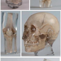 德国Erler Zimmer天然骨骼X-Ray训练模体