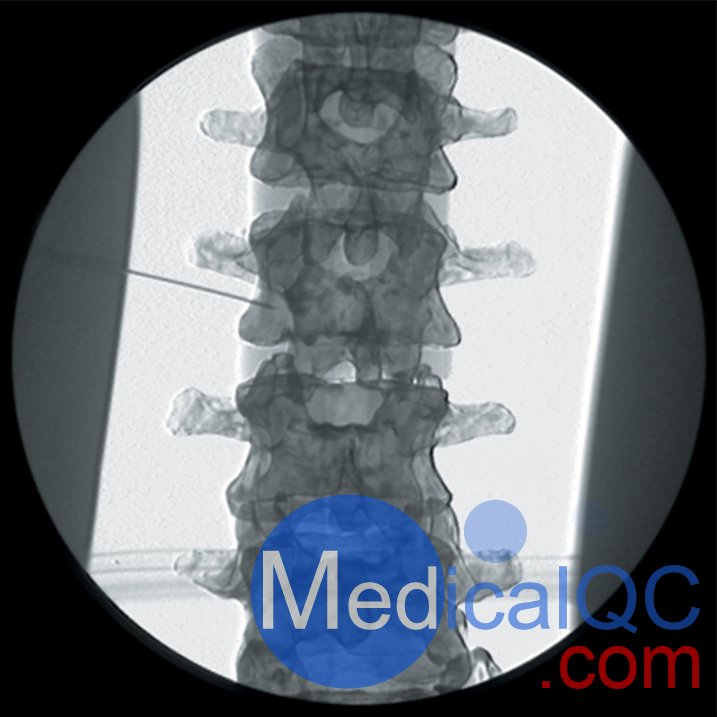 AR351脊椎穿刺模体，Adam，Rouilly脊椎穿刺模体