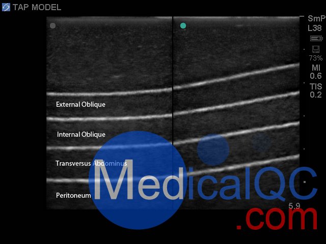 BP2001-TAP腹横肌超声训练模型,BP2001-TAP腹横肌超声模体