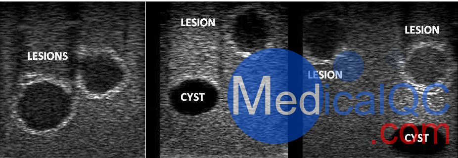 WEK-YMBP多功能乳腺模体，WEK-YMBP乳腺模体超声图像