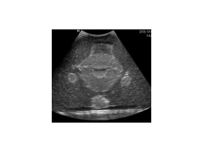CIrs 404A女性盆腔模体图2