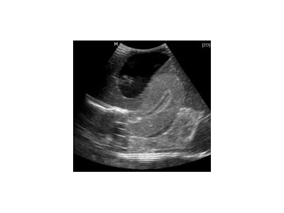 CIrs 404A女性盆腔模体图3