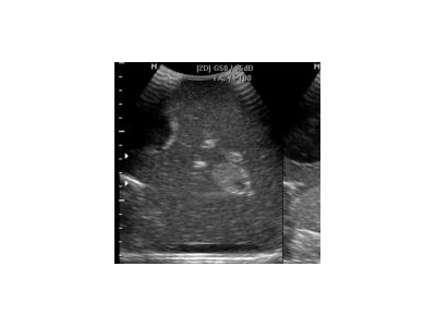 CIrs 404A女性盆腔模体图4