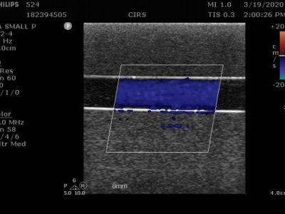 CIRS ATS524多普勒血流模体图3
