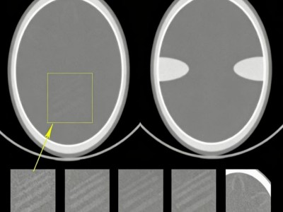 颅脑CT模型，Cranial CT Phantom图3