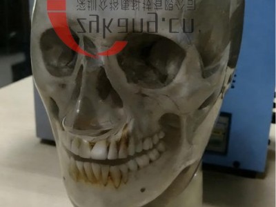 WEK-7300带颈椎头模,CBCT真人骨头模(可定制)图4