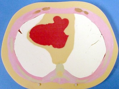 CIRS 600躯干模体图2