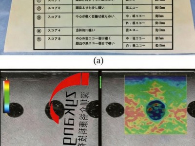 ELPT-002弹性成像模型图2