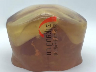 US-A03腹部模体图2